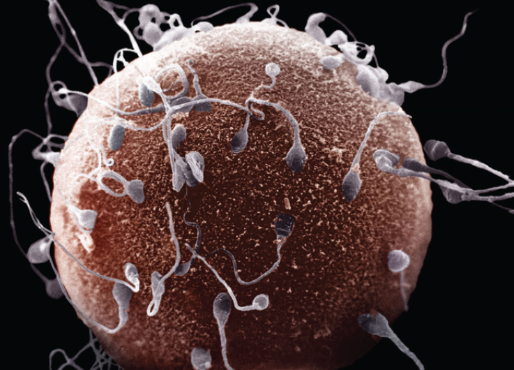 Ana from voluptuous xtra 11 Detect the presence of sperm